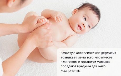 Allergiás dermatitis gyermeknél