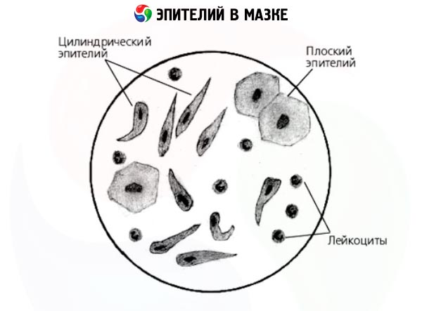 A hám epitéliuma a férfiakban normális)