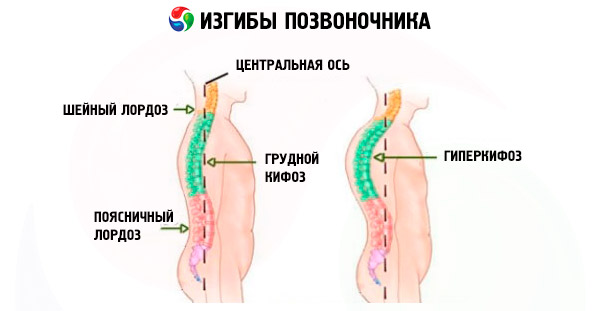 A gerinc ortopédiai betegségei