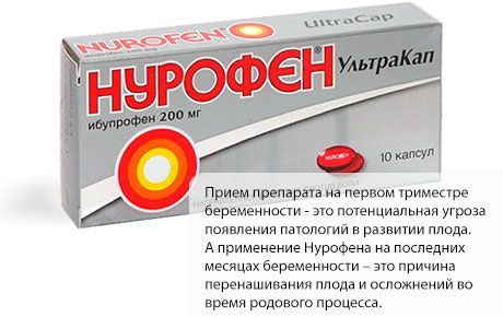 Nurofen terhesség alatt