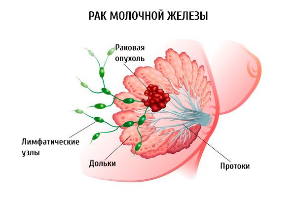 papilloma vírus a torok tüneteiben condilom Kirov