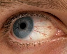 éles szemfájdalom 70 százalékos látás egy szemben