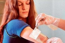 A fibrózis eltávolítása a prosztatában méz aloe- val a prosztatitisből