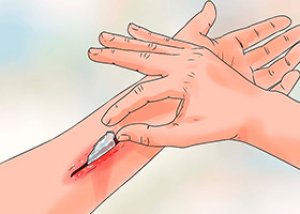 hpv nedir kad nlarda hogy néznek ki a féregtojások