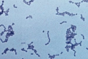 streptococcus viridans férfiak kenetében